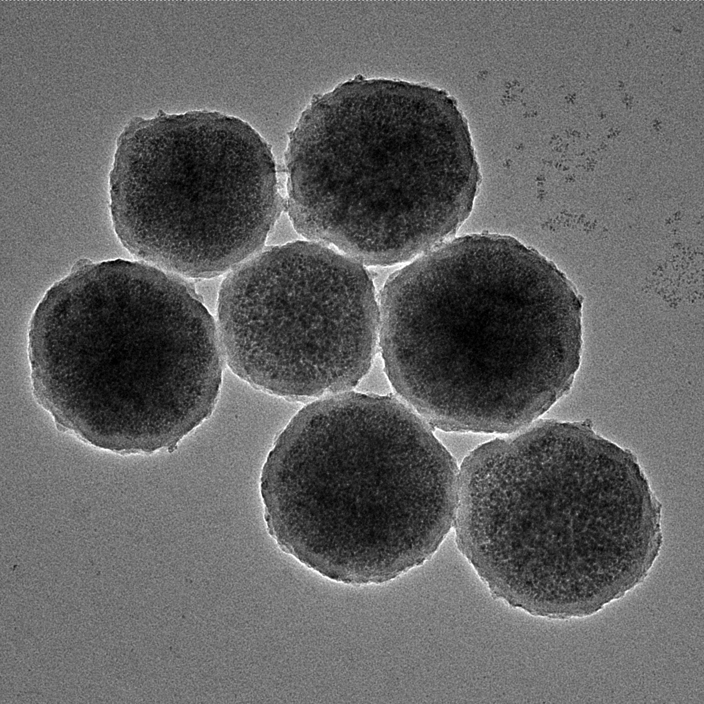 小さな磁気ロボットが脳内出血を治療する可能性(Tiny magnetic robots could treat bleeds in the brain)